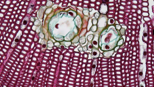 What is Oxidative Stress?