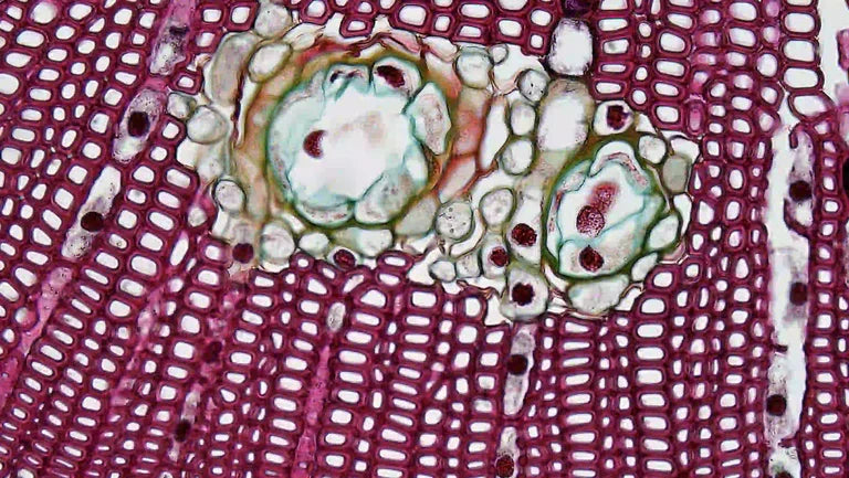 What is Oxidative Stress?